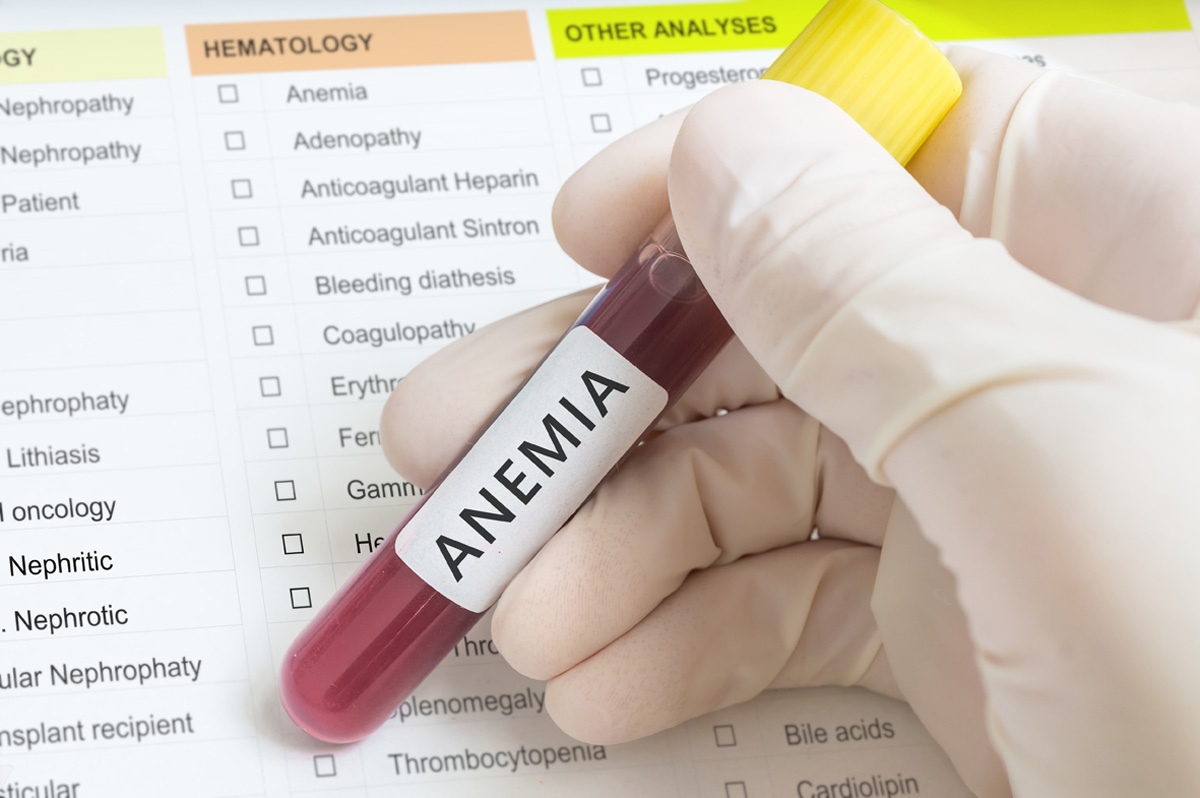 Tubo EDTA para pruebas de sangre. 